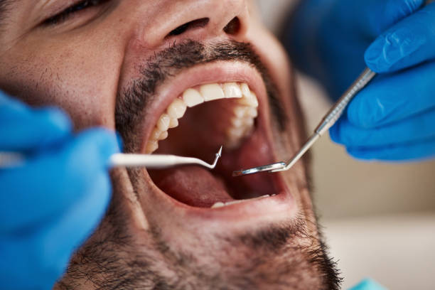Best Emergency Treatment for Oral Infections in Frisco City, AL